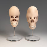 Vacuus Juvenilis (Large Skulls)